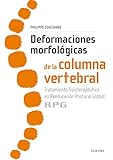 Deformaciones Morfológicas De La Columna Vertebral: Tratamiento fisioterapéutico en reeducación postural global RPG